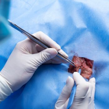 Non-Surgical Treatment